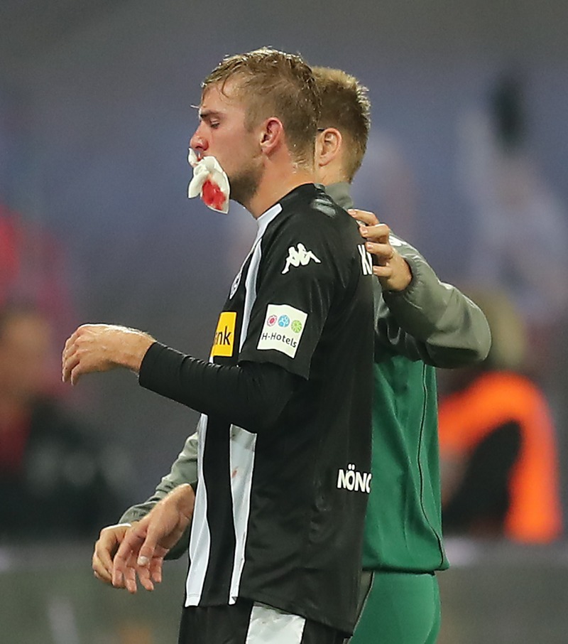 Der blutende 'Krieger' Christoph Kramer (Foto: Boris Streubel / Bongarts / Getty Images)